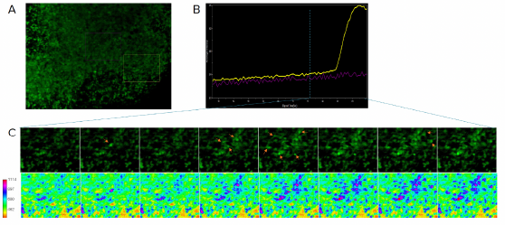 Imaging del calcio su organoidi cerebrali per determinare l’attività neuronale