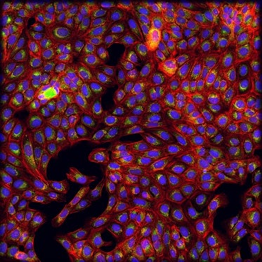 Cellule trattate con clorochina