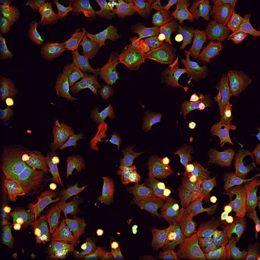 Cellule trattate con rotenone, una tossina frequentemente usata negli insetticidi