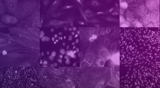 Recursion produce il più ampio set di dati morfologici sulle cellule umane pubblicamente disponibile per la ricerca di composti terapeutici per la COVID-19