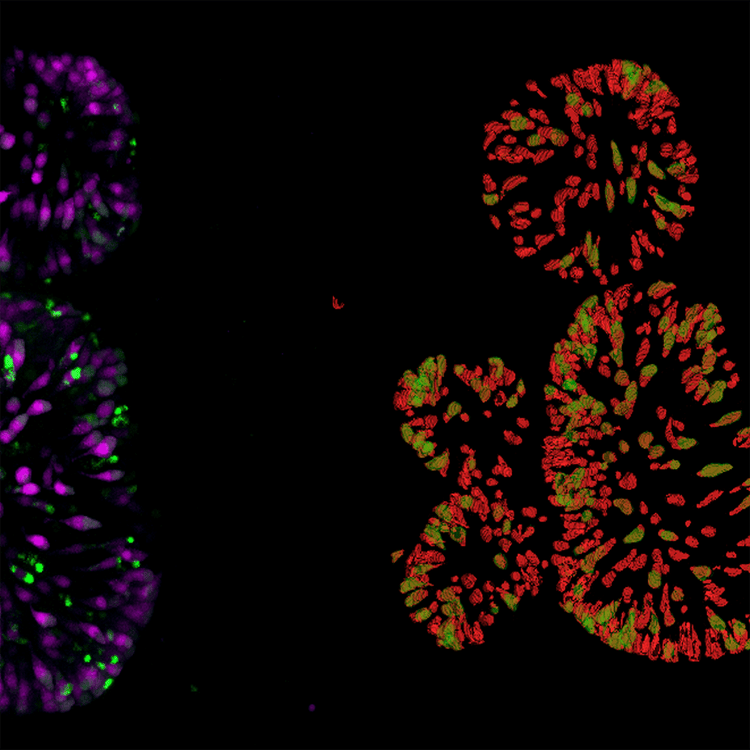 Tossicità mitocondriale con TRITC e DAPI utilizzando il sistema ImageXpress Pico