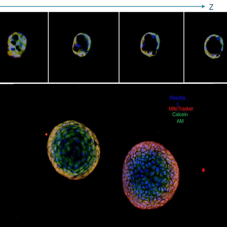 Overlay del danno al DNA in cellule U2OS con il sistema ImageXpress Nano