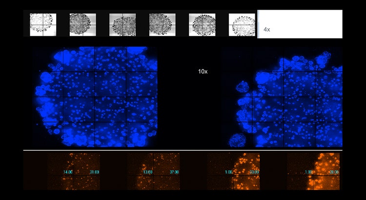 Imaging automatizzato di organoidi vivi in Matrigel, ingrandimento 4x o 10x