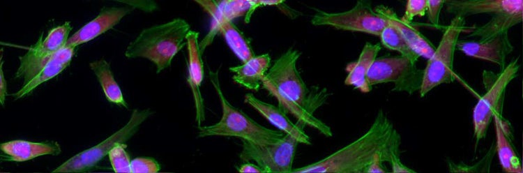 Imaging e analisi cellulare