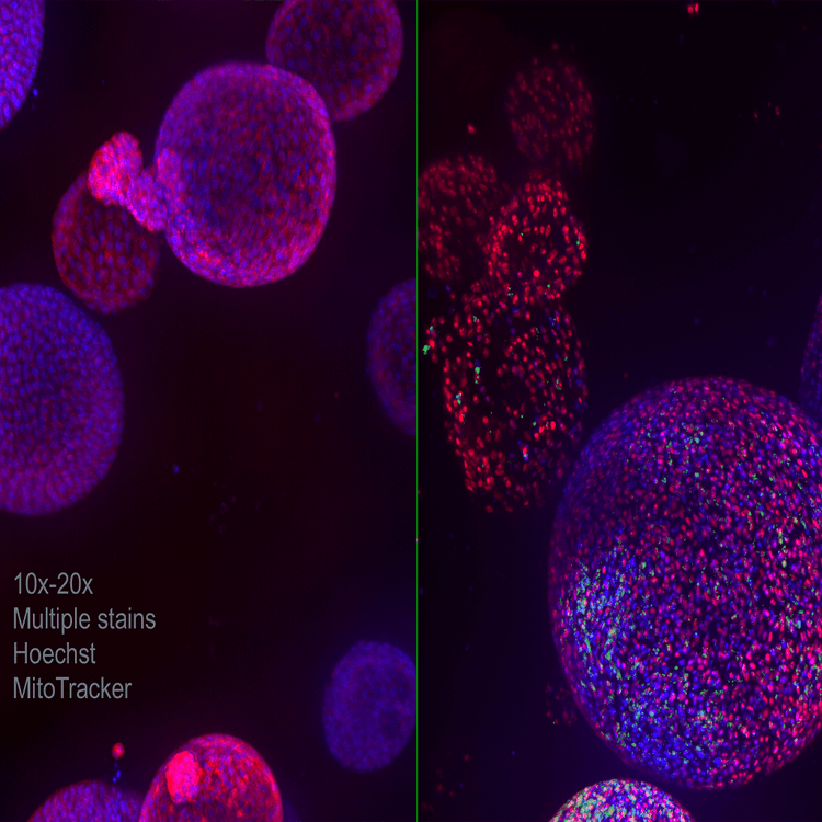 Nuclei con il colorante falloidina a un ingrandimento 60X utilizzando il sistema ImageXpress Nano