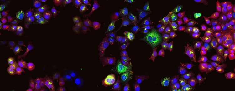 Ricerca oncologica