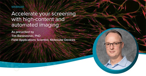 Imaging ad alto contenuto e automatizzato - Webinar