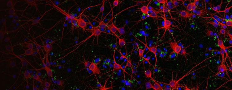 Crescita neuritica