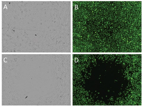 Cytochalasin D has a visible inhibitory effect on the level of cell migration into cell-free detection zone in 96-well plates