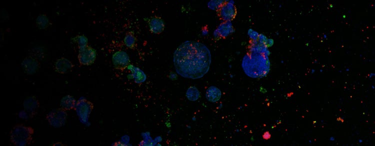 Intestinal Organoids