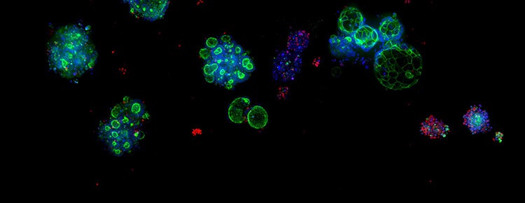 A case study for assay-ready patient-derived organoids (PDOs) and high-throughput 3D…