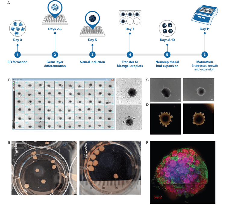 iPSC-derived cerebral organoids generated using the intrinsic patterning approach