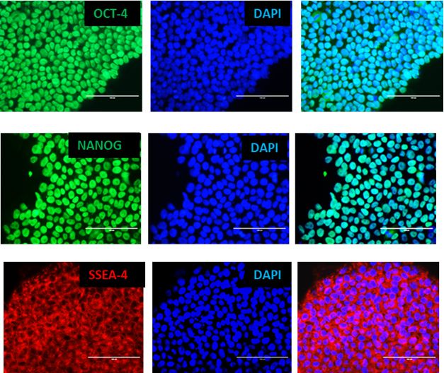 Le cellule iPS pluripotenti esprimono marcatori di pluripotenza: Oct-4, Nanog e SSEA4