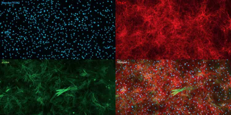 Immagini acquisite con il sistema di imaging cellulare automatizzato ImageXpress Pico di fibroblasti dermici in coltura isolati da pelle di vacca. Nuclei (blu), collagene (rosso), actina alfa della muscolatura liscia (verde)