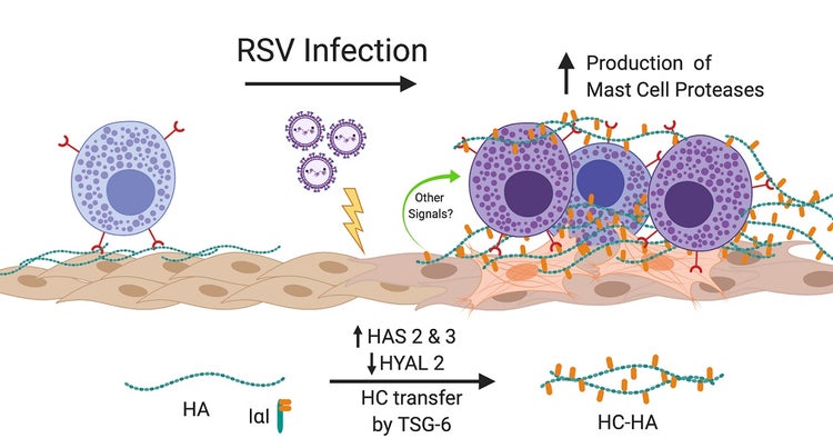 Infezioni di HLF con RSV
