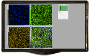 Software di analisi delle immagini MetaXpress