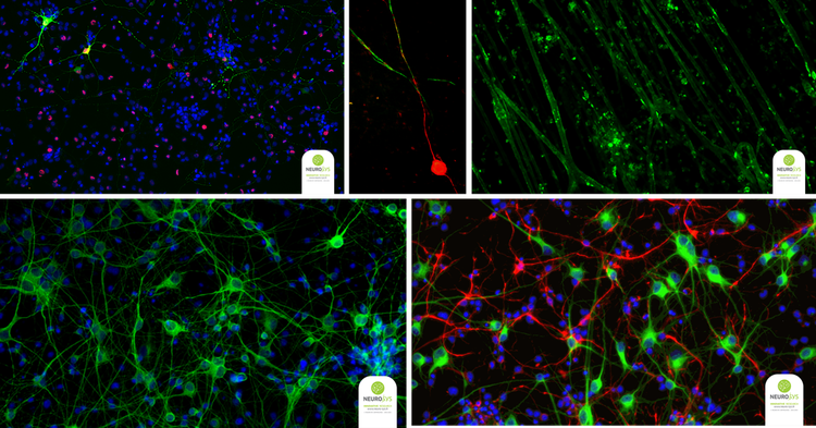 Giunzioni neuromuscolari, cinetica di mielinizzazione e proliferazione delle cellule gliali