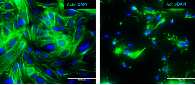 Distruzione del citoscheletro: epatociti derivati da iPSC non trattati o trattati con latrunculina, sottoposti a colorazione per l’actina