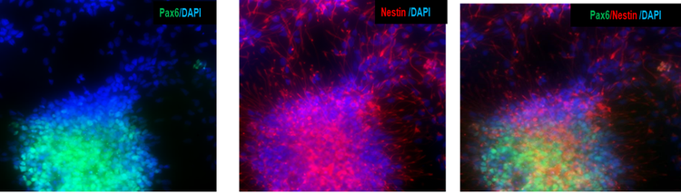 Le cellule progenitrici neurali derivate da iPSC esprimono i marcatori dei progenitori neurali PAX6 e nestina