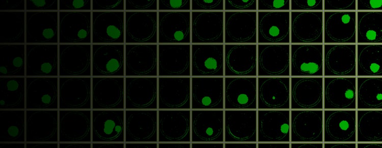 screening of CRISPR-edited cell lines