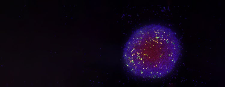 colorectal cancer organoids