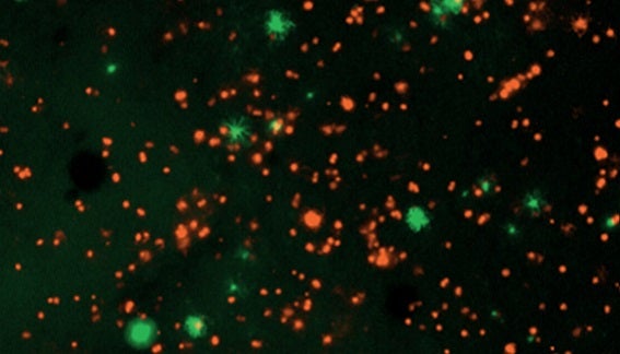 Imaging characterization of a 3D bioprinted ovarian cancer model