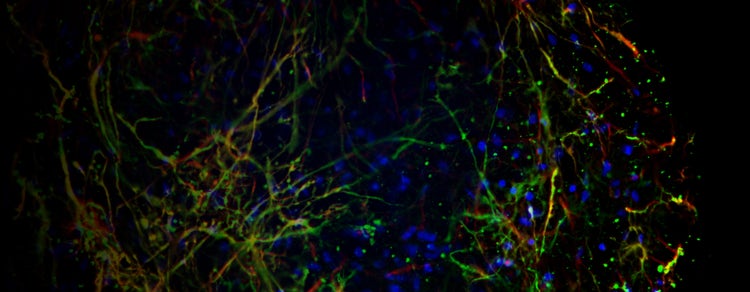 Traumatic Brain Injuries