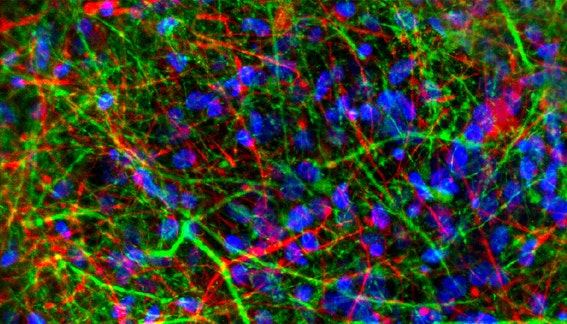 Phenotypic Screening With iPSC-Derived Cardiomyocytes and Neurons