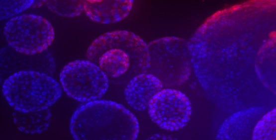 Microtessuti pluricellulari di organoidi (3D)