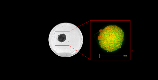 L’acquisizione mirata QuickID funziona acquisendo un intero campo visivo (Field-of-View, FoV)