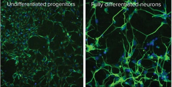 Espansione e differenziamento di cellule staminali neuronali