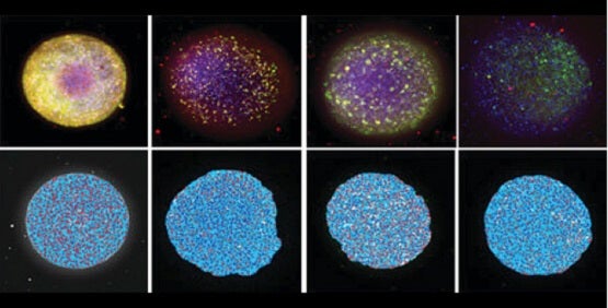 Neurotossicità, tossicità neuronale