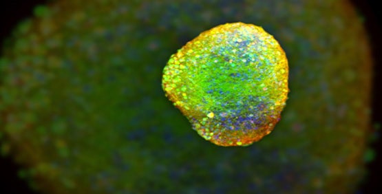 Soluzioni di neuroscienze e neurobiologia