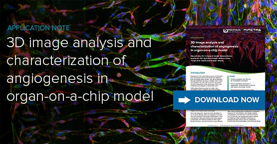 Analisi di immagini 3D e caratterizzazione dell’angiogenesi