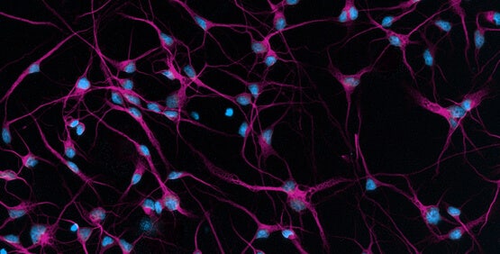 Cellule staminali pluripotenti indotte (iPSC)