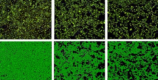 Cellule staminali differenziate in cardiomiociti