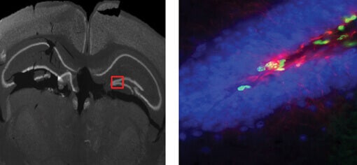 Ippocampo in un vetrino di tessuto cerebrale