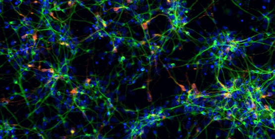 I plasmidi alla base delle principali scoperte sulle cellule staminali