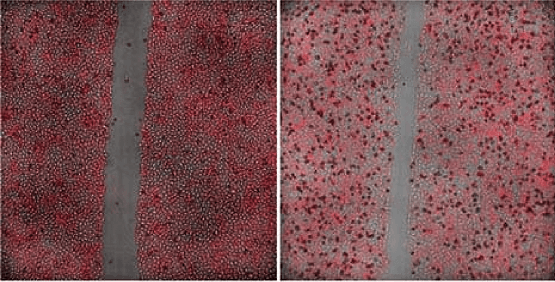 Analisi dell’area delle cellule mediante imaging in luce trasmessa o a fluorescenza