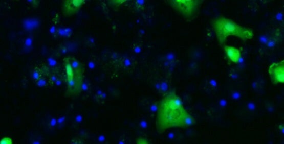 Cellule staminali differenziate in epatociti