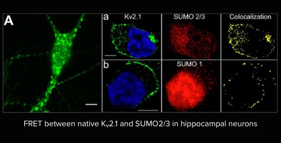 Sincronizzazione degli studi di elettrofisiologia e di imaging