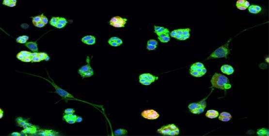 Le cellule vengono coltivate in una matrice extracellulare (MEC) per simulare un ambiente in vivo