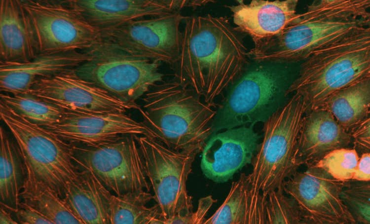 Sistema di imaging automatizzato Nano