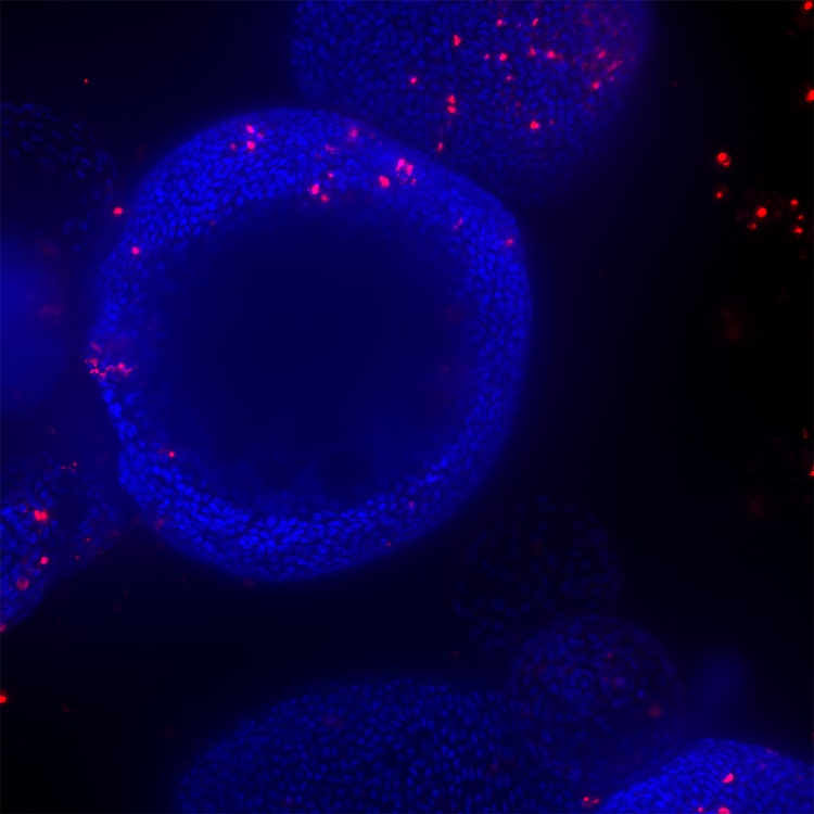 HT.ai Organoide con buco nero