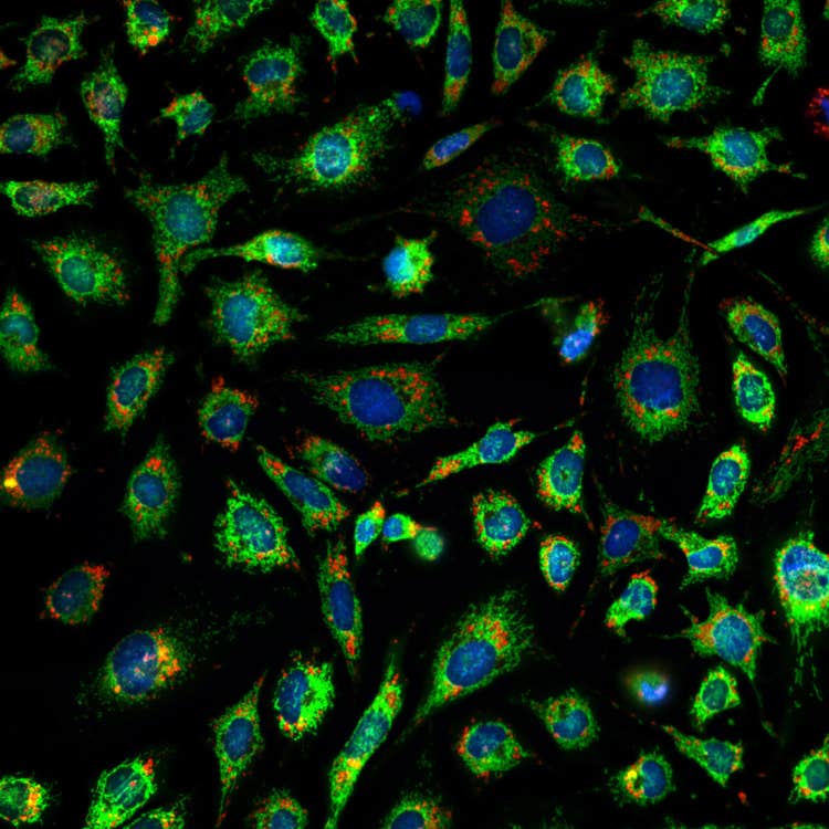 Soluzioni di imaging ad alto contenuto Micro 4