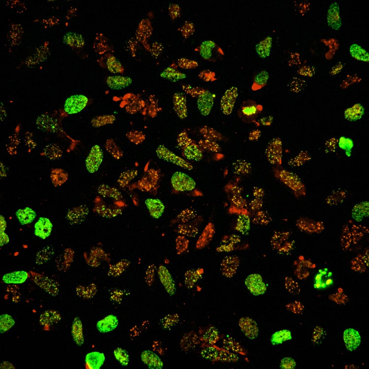 Soluzione di imaging ad alto contenuto Micro Confocal
