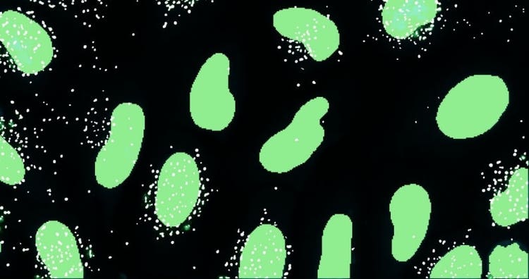 Analisi di C16 nelle vescicole