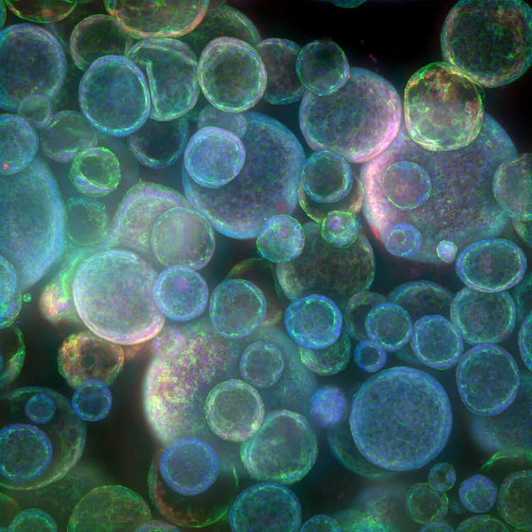 immagine di organoide ottenuta con il sistema ImageXpress Confocal HT.ai utilizzando il software In Carta