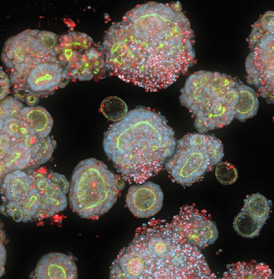 Modelli umani in vitro