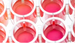 Selecting the Right Cell-Based Assay